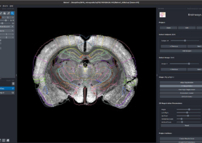 Brainways: An Open-Source AI-based Software For Registration and Analysis of Fluorescent Markers on Coronal Brain Slices