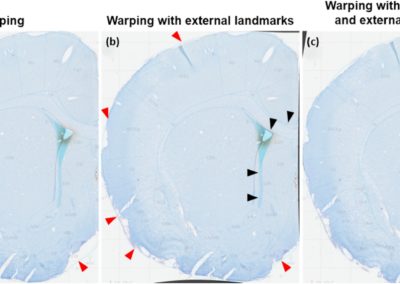 ABA: Atlas-Based Analysis