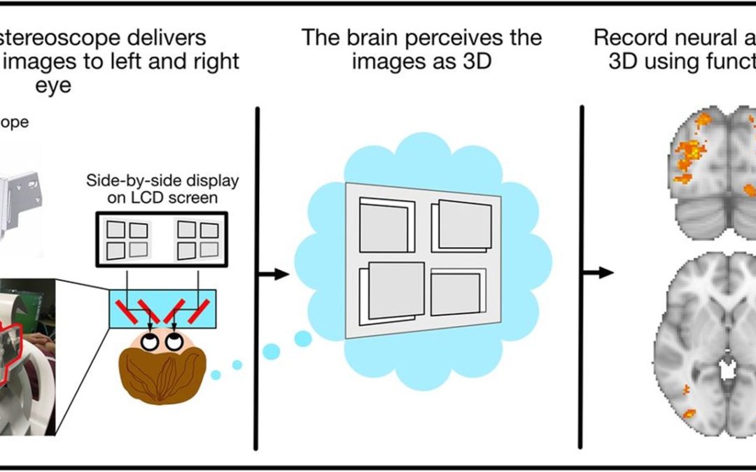 MRI Stereoscope