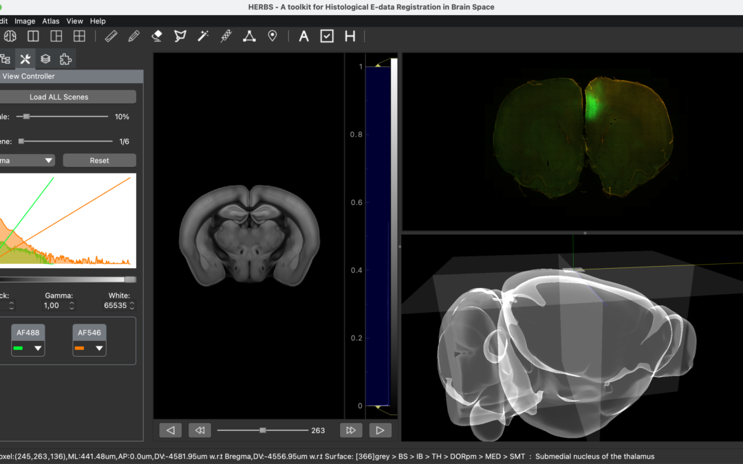 HERBS: Histological E-data Registration in rodent Brain Spaces