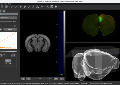 HERBS: Histological E-data Registration in rodent Brain Spaces