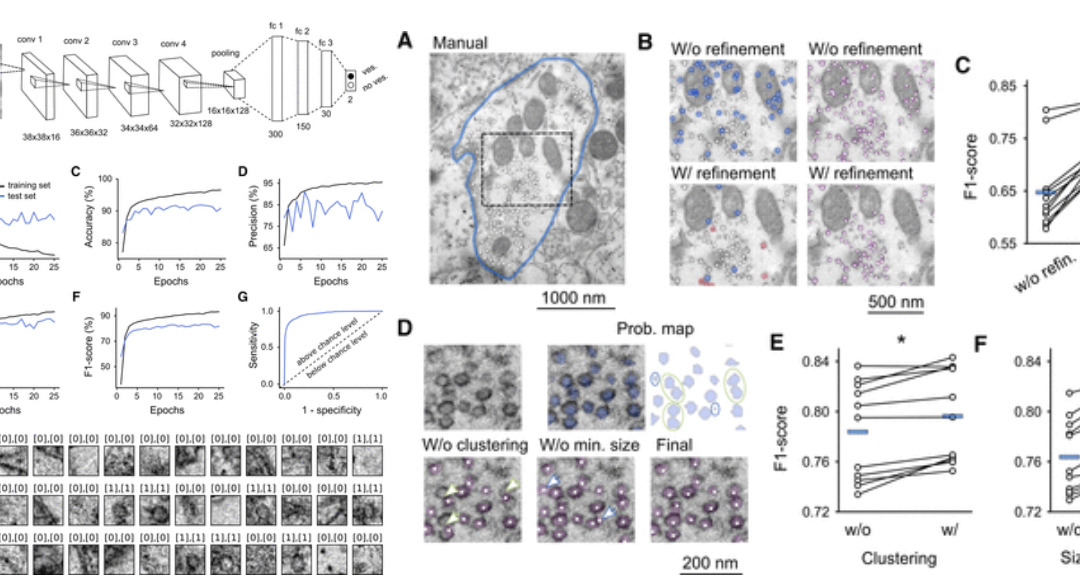 Synaptic Vesicles Detection and Localization