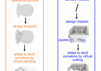 custom-fitting cranial implants